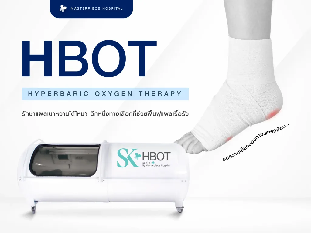 HBOT รักษาแผลเบาหวานได้ไหม? อีกหนึ่งทางเลือกที่ช่วยฟื้นฟูแผลเรื้อรัง ลดความเสี่ยงของภาวะแทรกซ้อน