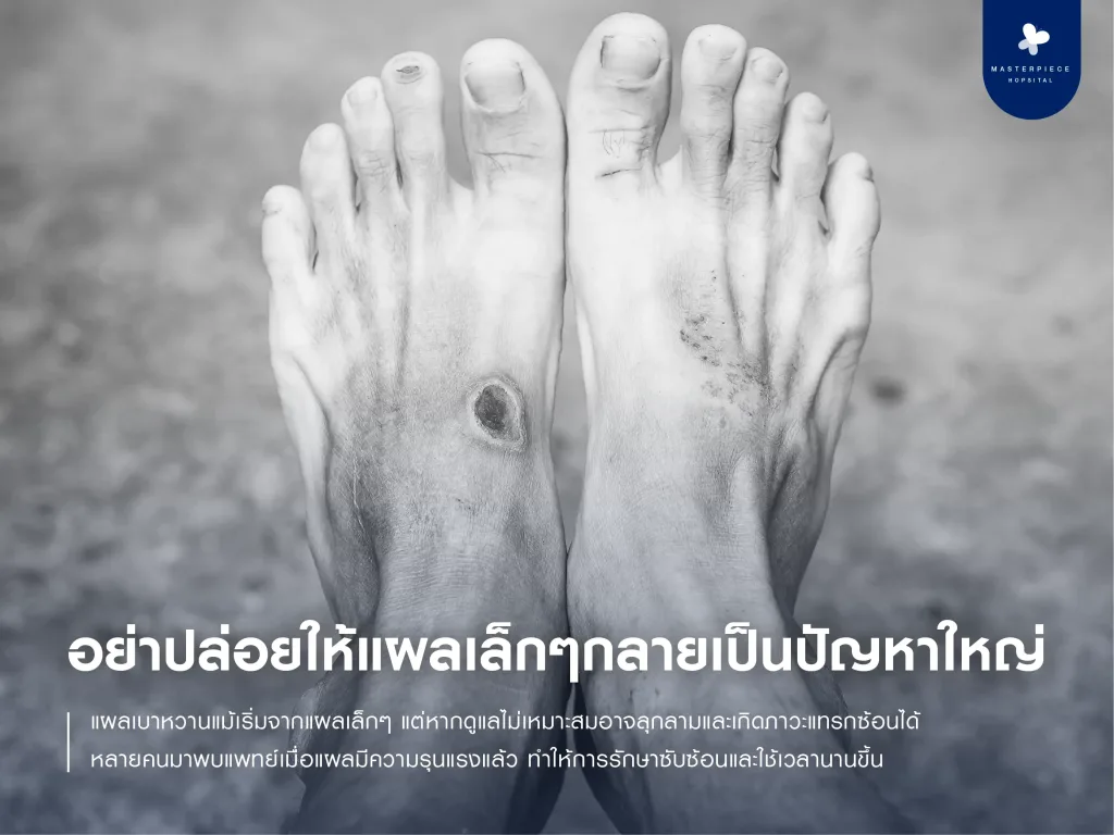 อย่าปล่อยให้แผลเล็ก ๆ กลายเป็นปัญหาใหญ่