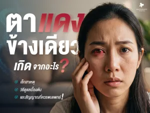 ตาแดงข้างเดียวเกิดจากอะไร รู้ทันสาเหตุ วิธีดูแล และอาการที่ควรพบแพทย์
