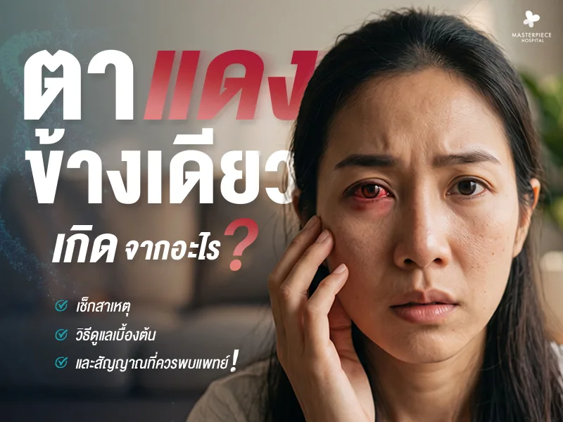 ตาแดงข้างเดียวเกิดจากอะไร รู้ทันสาเหตุ วิธีดูแล และอาการที่ควรพบแพทย์