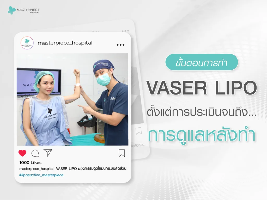 ขั้นตอนการทำ Vaser Lipo ตั้งแต่การประเมินจนถึงการดูแลหลังทำ