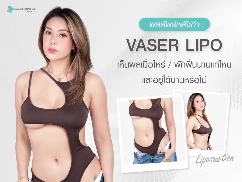 ผลลัพธ์หลังทำ Vaser Lipo เห็นเมื่อไหร่ พักฟื้นนานแค่ไหน และอยู่ได้นานหรือไม่