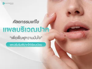 ศัลยกรรมแก้ไขแผลเป็นบริเวณปากเพื่อฟื้นฟูความมั่นใจและปรับริมฝีปากให้เรียบเนียน