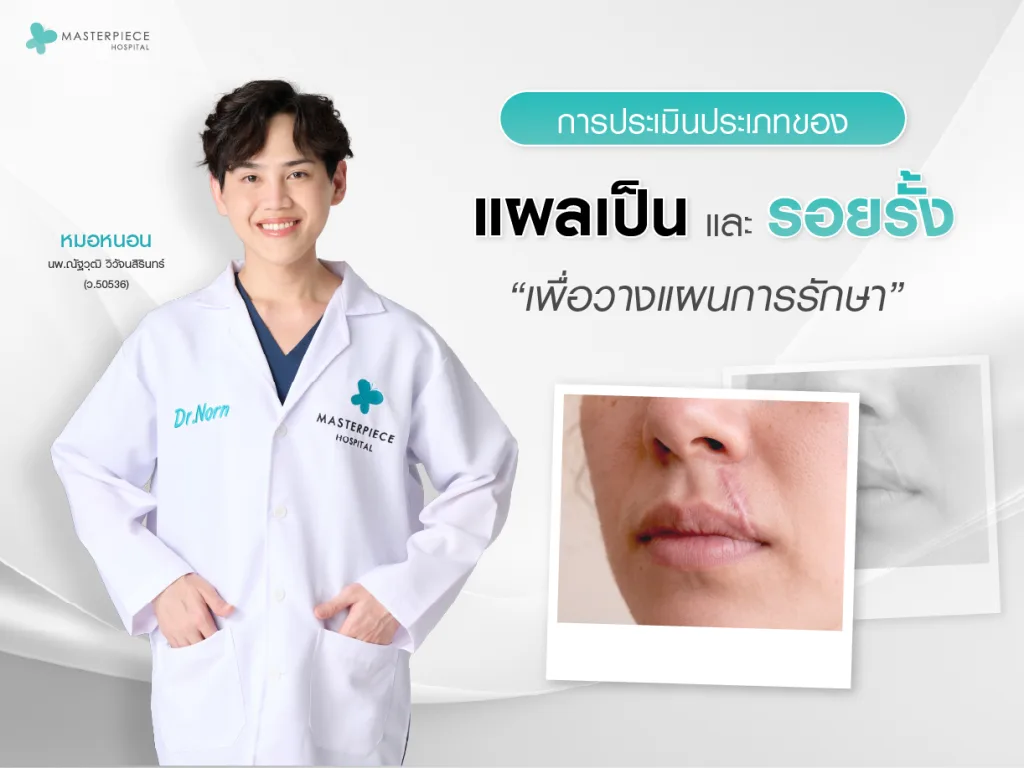 การประเมินประเภทของแผลเป็นและรอยรั้งเพื่อวางแผนการรักษา