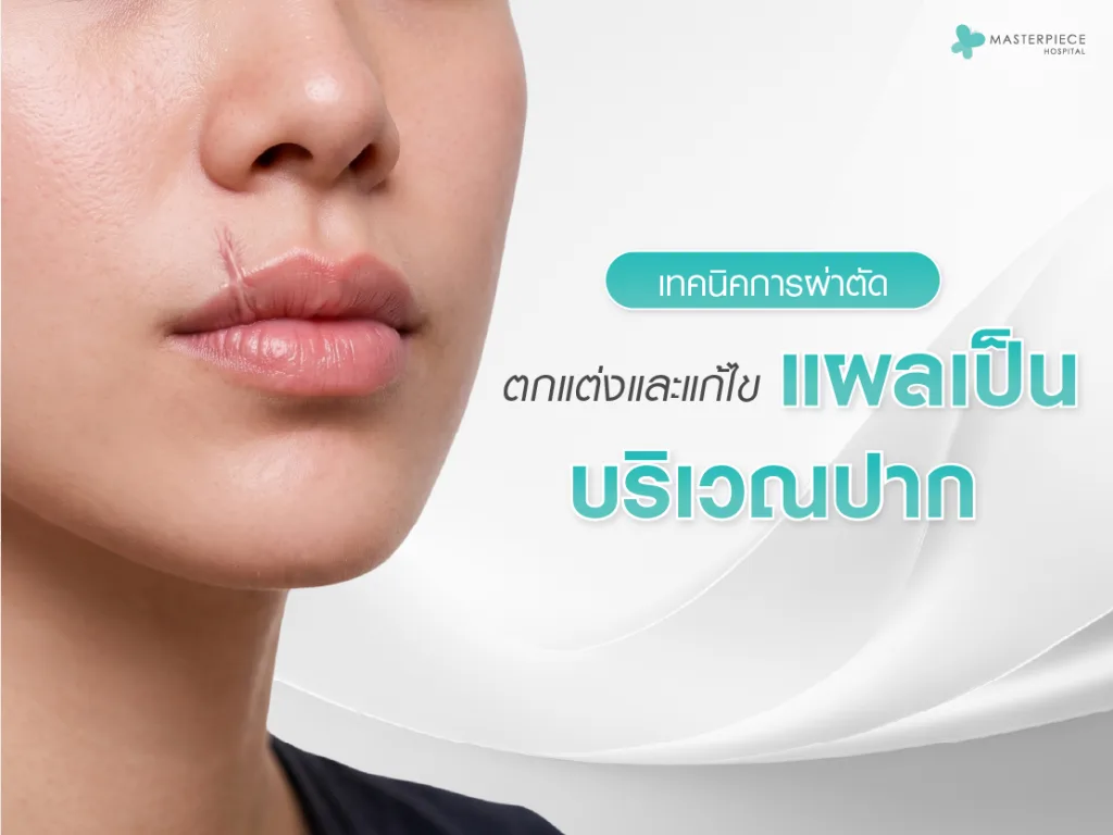 เทคนิคการผ่าตัดตกแต่งและแก้ไขแผลเป็นบริเวณปาก