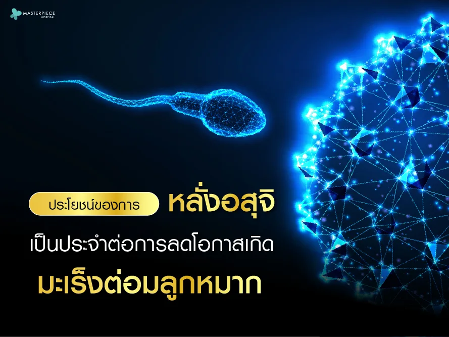 ประโยชน์ของการหลั่งอสุจิเป็นประจำต่อการลดโอกาสเกิดโรคมะเร็งต่อมลูกหมาก