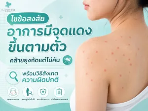 ไขข้อสงสัยอาการมีจุดแดงขึ้นตามตัวคล้ายยุงกัดแต่ไม่คัน พร้อมวิธีสังเกตความผิดปกติ