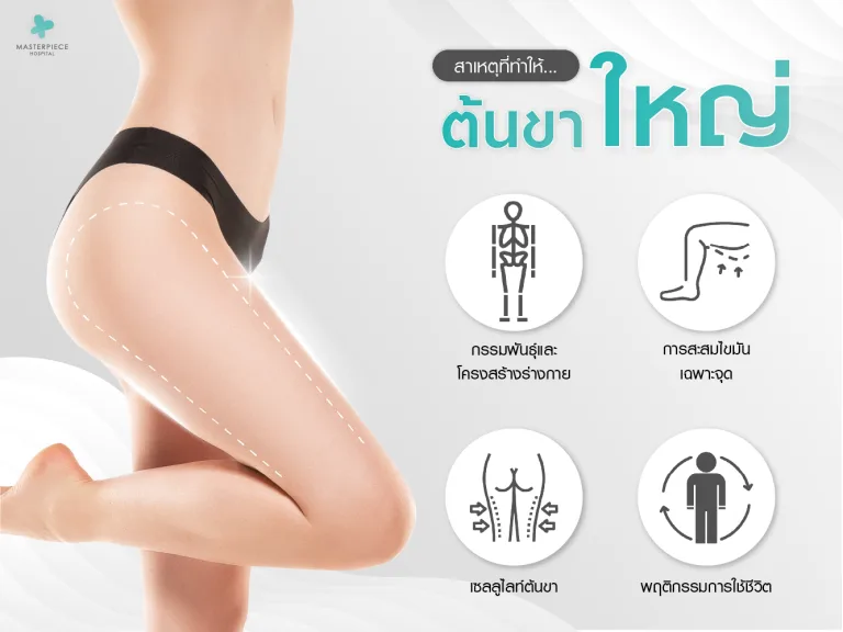 สาเหตุที่ทำให้ต้นขาใหญ่