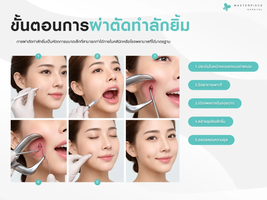 ขั้นตอนการผ่าตัดทำลักยิ้ม