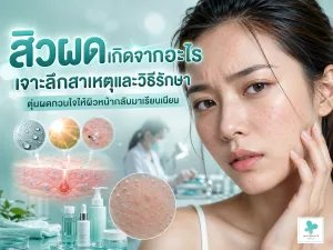 สิวผดเกิดจากอะไร เจาะลึกสาเหตุและวิธีรักษาตุ่มผดกวนใจให้ผิวหน้ากลับมาเรียบเนียน