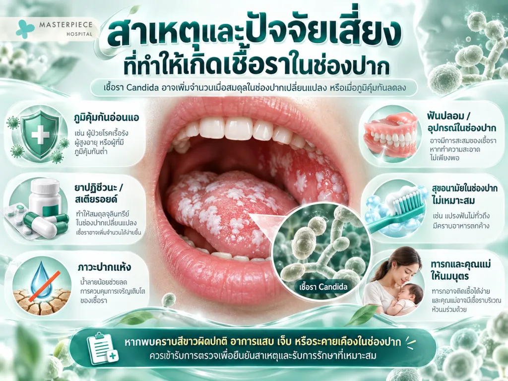 สาเหตุและปัจจัยเสี่ยงที่ทำให้เกิดเชื้อราในช่องปาก