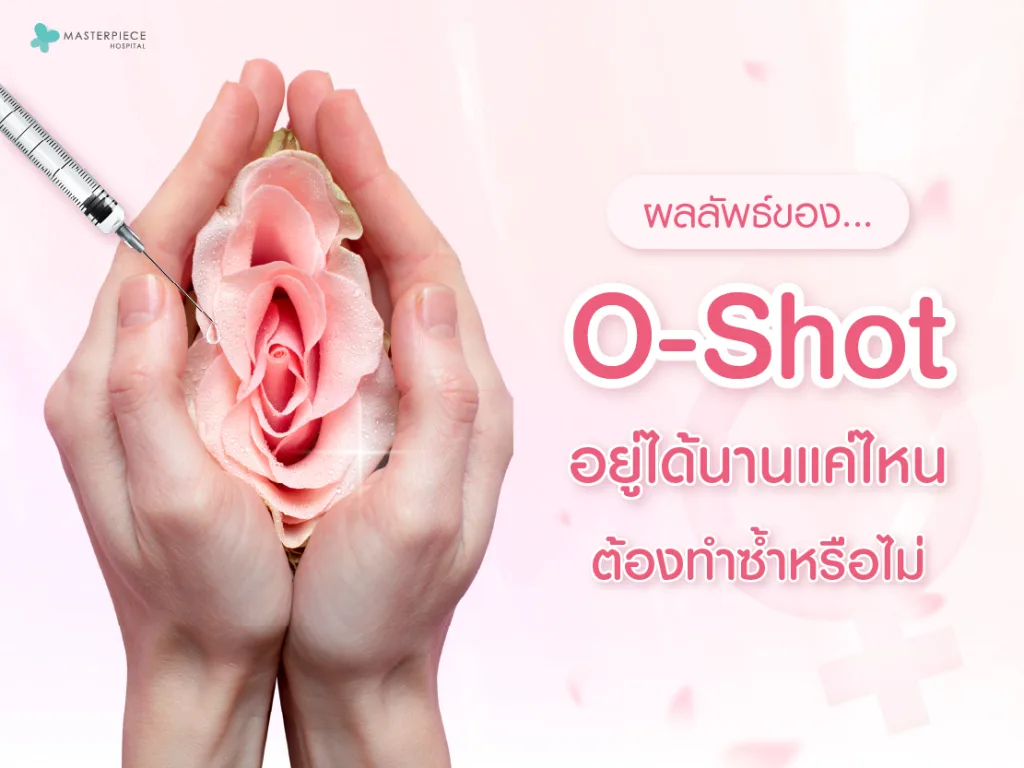 ผลลัพธ์ของ O-Shot อยู่ได้นานแค่ไหน ต้องทำซ้ำหรือไม่