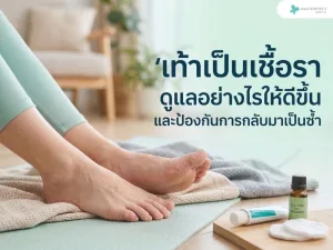 เท้าเป็นเชื้อรา ดูแลอย่างไรให้ดีขึ้นและป้องกันการกลับมาเป็นซ้ำ