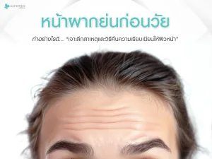 หน้าผากย่นก่อนวัยทำอย่างไรดี เจาะลึกสาเหตุและวิธีคืนความเรียบเนียนให้ผิวหน้า
