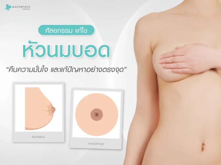 ศัลยกรรมแก้ไขหัวนมบอด คืนความมั่นใจและแก้ปัญหาอย่างตรงจุด