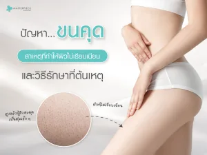 ปัญหาขนคุด สาเหตุที่ทำให้ผิวไม่เรียบเนียนและวิธีรักษาที่ต้นเหตุ