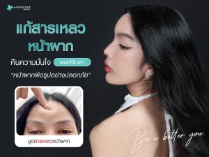 แก้สารเหลวหน้าผาก คืนความมั่นใจและแก้ปัญหาหน้าผากผิดรูปอย่างปลอดภัย