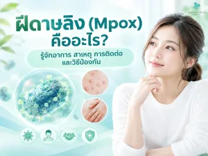 ฝีดาษลิง (Mpox) คืออะไร? รู้จักอาการ สาเหตุ การติดต่อ และวิธีป้องกัน