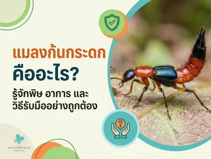 แมลงก้นกระดก คืออะไร? รู้จักพิษ อาการ และวิธีรับมืออย่างถูกต้อง